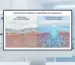 Hydrogel_vs_Fabric_Science